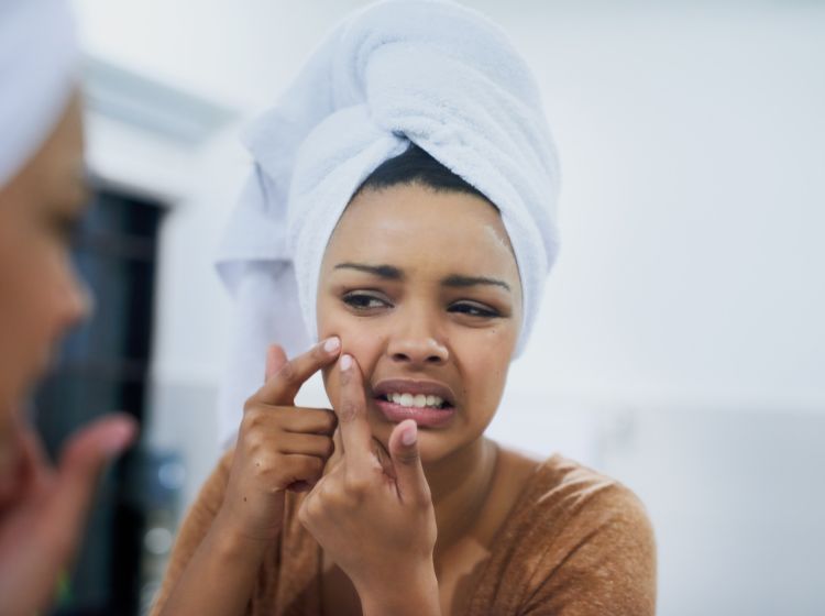 Blind Pimples Are a Nightmare But... These 9 Methods Will Help!