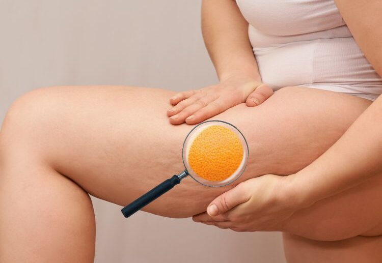 does anti cellulite massage work at home