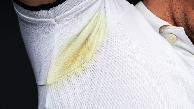 how to avoid getting yellow stains on white shirts