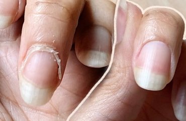 how to clean nail cuticles at home