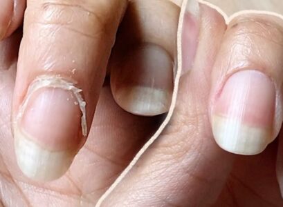 how to clean nail cuticles at home