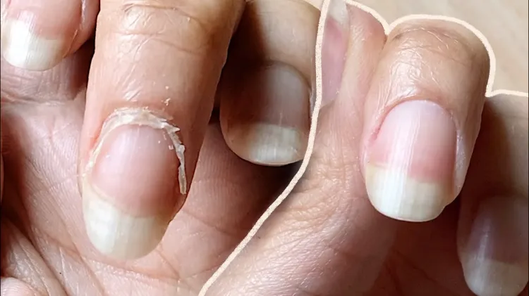 how to remove cuticles at home naturally