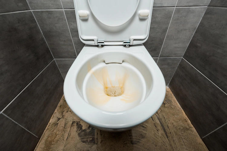 if there are accumulations of urine and limescale you have to clen yellowed toilet seats