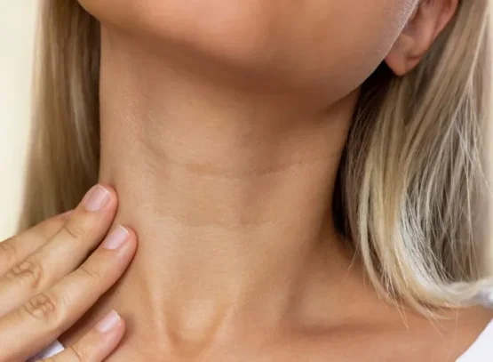 how to get rid of wrinkles on neck for every age