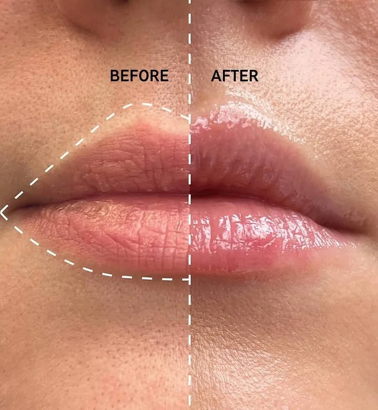 before after inkey list tripeptide pumping balm
